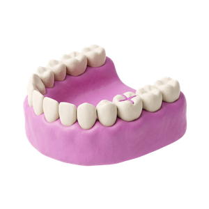 Gum Surgeries
