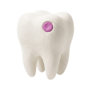 Teeth Filling